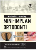 Mini-implan ortodonti.