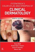 Fitzpatrick's Color Atlas and Synopsis of Clinical Dermatology, 8th ed.