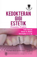 Kedokteran gigi estetik : prosedur praktis.